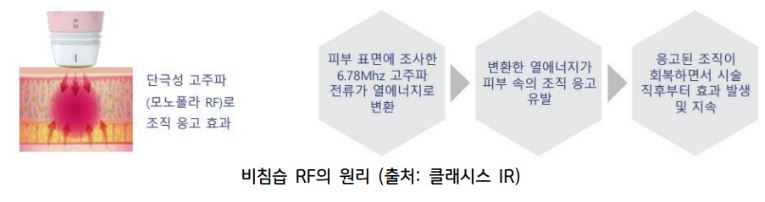 '비침습 rf'의 원리를 보여주는 '클래시스'의 자료.